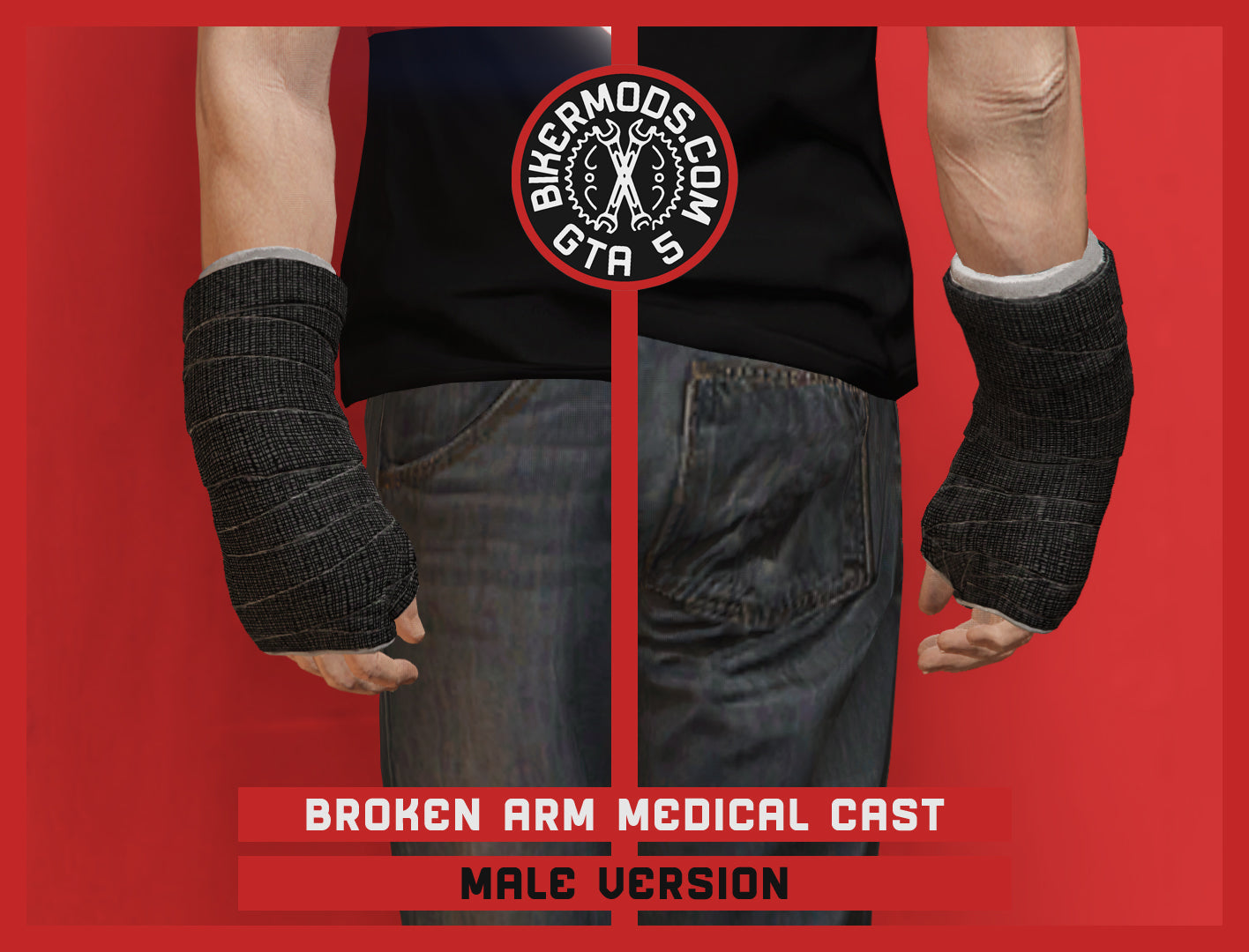 Broken Arm Medical Cast (Male) Right Hand Side