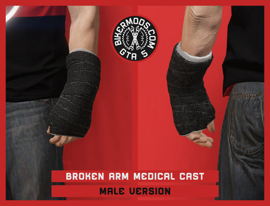 Broken Arm Medical Cast (Male) Left Hand Side
